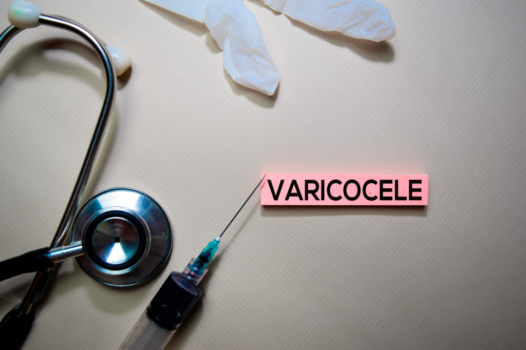 varicocele